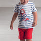 Completo in cotone cotone rigato con stampa e pantaloncino in contrasto con tasche e risvolti